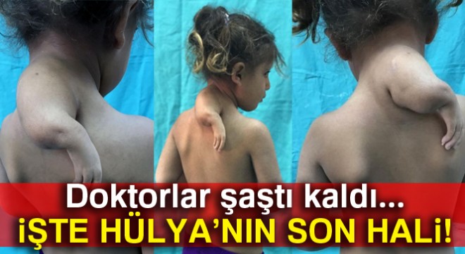 3. kolu boynunda dünyaya geldi