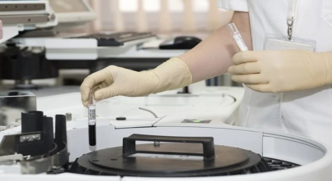 4 milyon 746 bin Kaşgarlı'nın Covid-19 testini 2 günde tamamladı