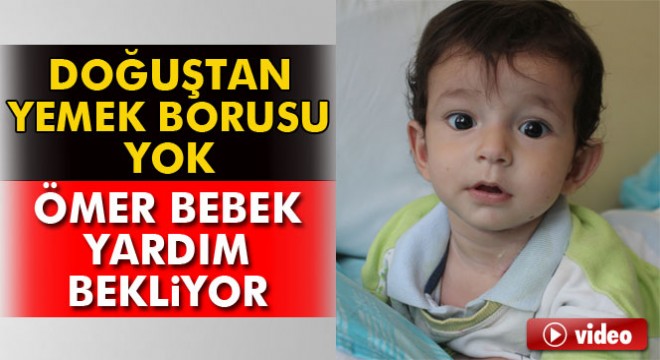 Doğuştan yemek borusu olmayan bebek yardım bekliyor